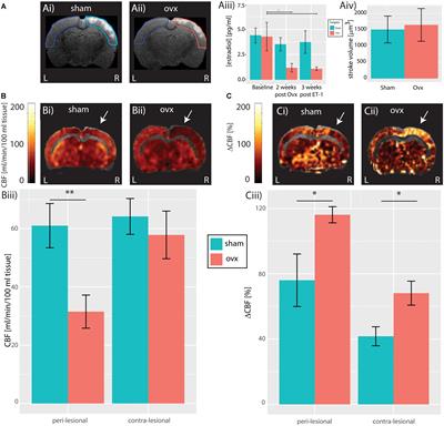 Oophorectomy Reduces Estradiol Levels and Long-Term Spontaneous Neurovascular Recovery in a Female Rat Model of Focal Ischemic Stroke